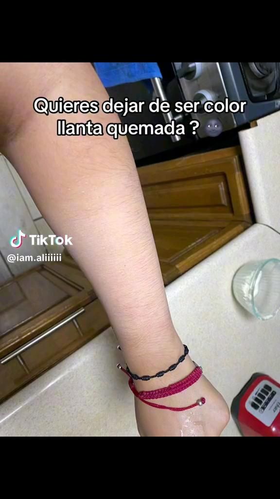 Top Creams: Banish Sun Spots and Achieve Radiant Skin